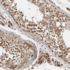 Anti-VPS50 Antibody