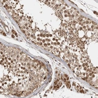 Immunohistochemical staining of human testis shows moderate to strong cytoplasmic and nuclear positivity in cells in seminiferous ducts.