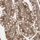 Immunohistochemical staining of human small intestine shows moderate cytoplasmic positivity in glandular cells.