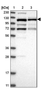 Lane 1: Marker [kDa] 230, 130, 95, 72, 56, 36, 28, 17, 11_br/_Lane 2: Human cell line RT-4_br/_Lane 3: Human cell line U-251MG sp