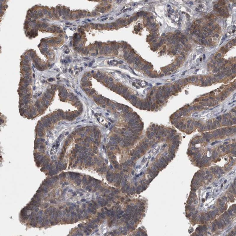 Anti-APRT Antibody