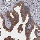 Immunohistochemical staining of human prostate shows moderate cytoplasmic positivity in glandular cells.