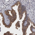 Immunohistochemical staining of human prostate shows moderate cytoplasmic positivity in glandular cells.
