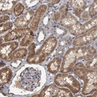 Immunohistochemical staining of human kidney shows moderate cytoplasmic positivity in cells in tubules.