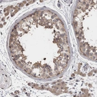 Immunohistochemical staining of human testis shows moderate cytoplasmic positivity in cells in seminiferous ducts and Leydig cells.