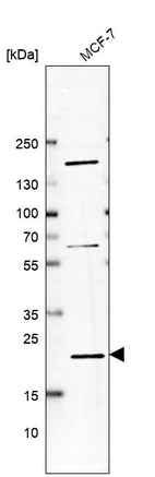 Western blot analysis in human cell line MCF-7.