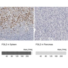 Anti-FGL2 Antibody