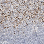 Immunohistochemical staining of human spleen shows strong cytoplasmic positivity in cells in red pulp.