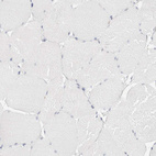 Immunohistochemical staining of human skeletal muscle shows no positivity in myocytes as expected.