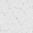 Immunohistochemical staining of human skeletal muscle shows no positivity in myocytes as expected.