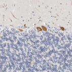 Immunohistochemical staining of human cerebellum shows moderate cytoplasmic positivity in Purkinje cells.