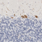 Immunohistochemical staining of human cerebellum shows moderate cytoplasmic positivity in Purkinje cells.