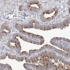 Anti-IFT74 Antibody