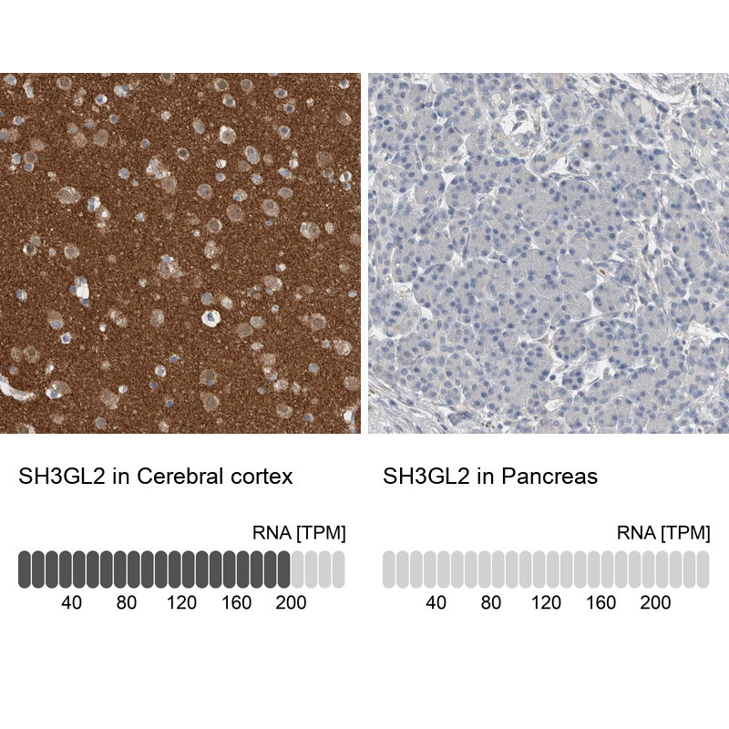 Anti-SH3GL2 Antibody