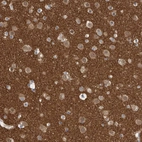 Immunohistochemical staining of human cerebral cortex shows high expression.