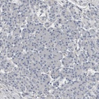 Anti-SH3GL2 Antibody