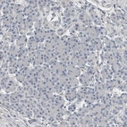 Immunohistochemical staining of human pancreas shows low expression as expected.