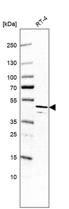 Western blot analysis in human cell line RT-4.