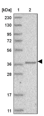 Lane 1: Marker [kDa] 230, 130, 95, 72, 56, 36, 28, 17, 11_br/_Lane 2: Human cell line RT-4