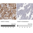 Anti-SUGCT Antibody