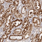 Anti-SUGCT Antibody