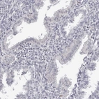 Immunohistochemical staining of human endometrium shows low expression as expected.