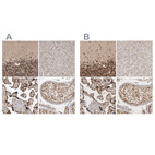 Anti-CBLL1 Antibody