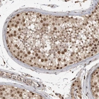 Immunohistochemical staining of human testis shows strong nuclear positivity in cells in seminiferous ducts.