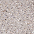 Immunohistochemical staining of human liver shows very weak positivity in hepatocytes as expected.
