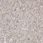 Immunohistochemical staining of human liver shows very weak positivity in hepatocytes as expected.