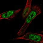 Anti-CBLL1 Antibody