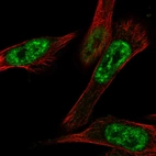 Immunofluorescent staining of human cell line U-251 MG shows localization to nuclear speckles.