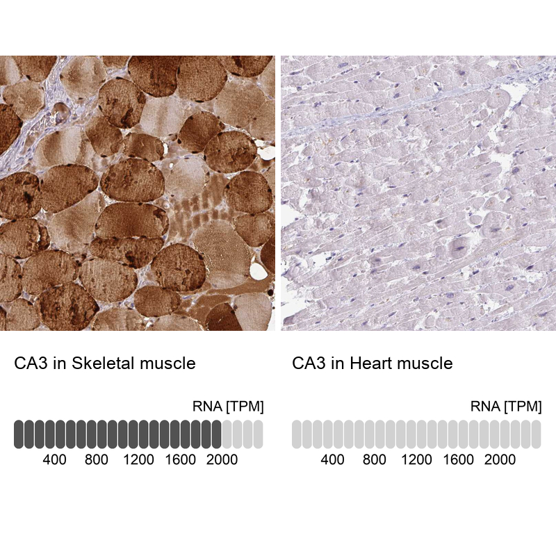 Anti-CA3 Antibody
