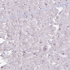 Immunohistochemical staining of human heart muscle shows low expression as expected.