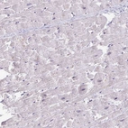 Immunohistochemical staining of human heart muscle shows low expression as expected.