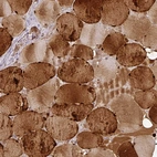 Immunohistochemical staining of human skeletal muscle shows high expression.