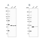 Western blot analysis using Anti-CA3 antibody HPA026700 (A) shows similar pattern to independent antibody HPA021775 (B).