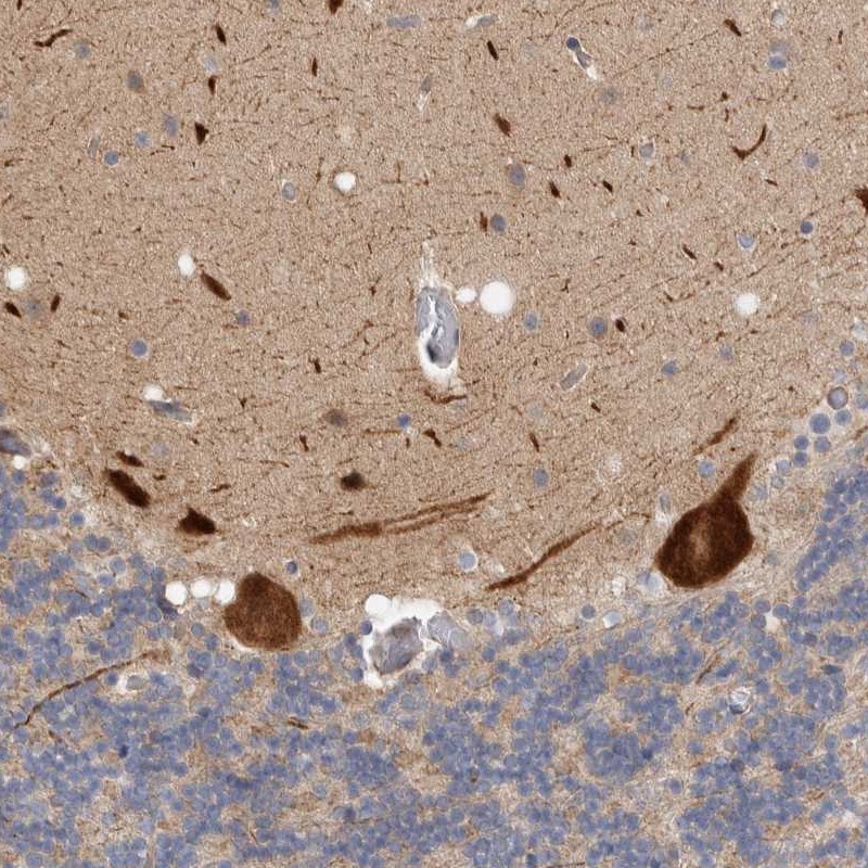 Anti-ZNF804B Antibody