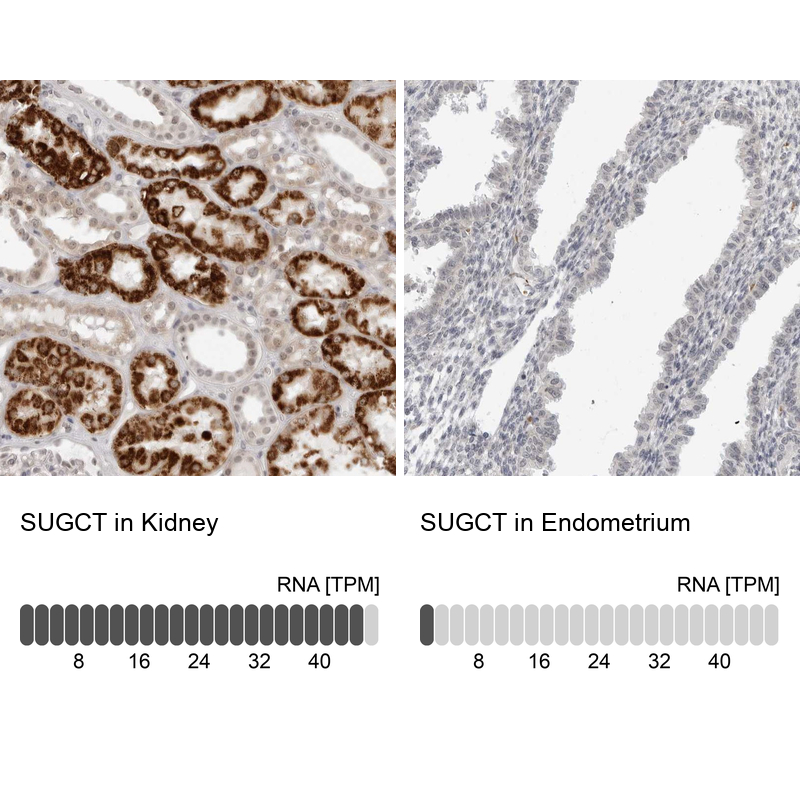 Anti-SUGCT Antibody