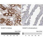 Anti-SUGCT Antibody
