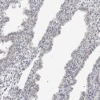 Immunohistochemical staining of human endometrium shows low expression as expected.