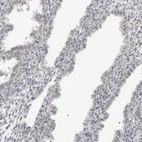 Immunohistochemical staining of human endometrium shows low expression as expected.