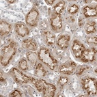 Anti-SUGCT Antibody