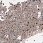Anti-BZW2 Antibody