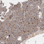 Anti-BZW2 Antibody
