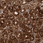 Anti-PDCD2 Antibody