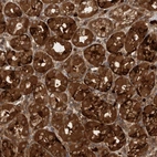 Anti-PDCD2 Antibody
