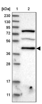 Lane 1: Marker [kDa] 230, 130, 95, 72, 56, 36, 28, 17, 11_br/_Lane 2: Human cell line RT-4