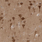 Anti-PRKAR1B Antibody