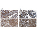 Anti-MDH2 Antibody